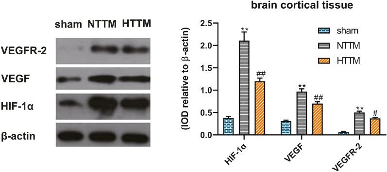 https://cdn.ncbi.nlm.nih.gov/pmc/blobs/067a/7785329/5f650ba54248/12028_2020_1166_Fig4_HTML.jpg