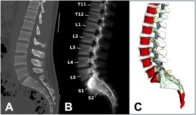 https://cdn.ncbi.nlm.nih.gov/pmc/blobs/0683/11669511/56d9c28acd4f/fendo-15-1521680-g002.jpg