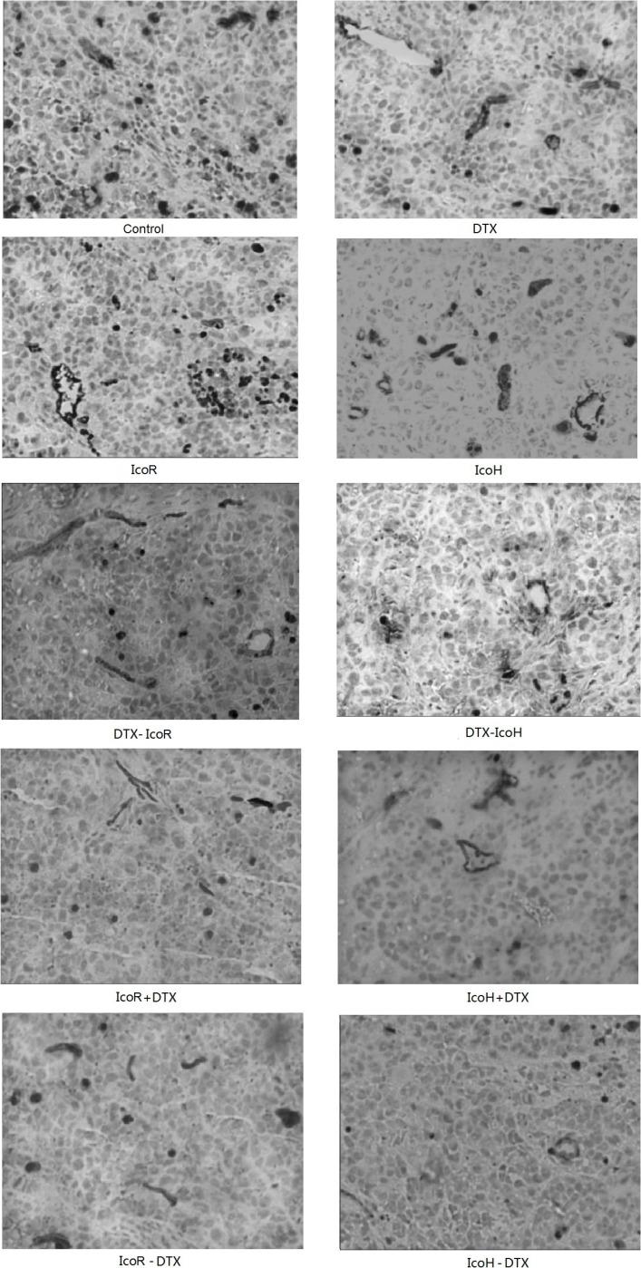 https://cdn.ncbi.nlm.nih.gov/pmc/blobs/0684/5354720/6f6c60b4cb08/oncotarget-08-9134-g003.jpg