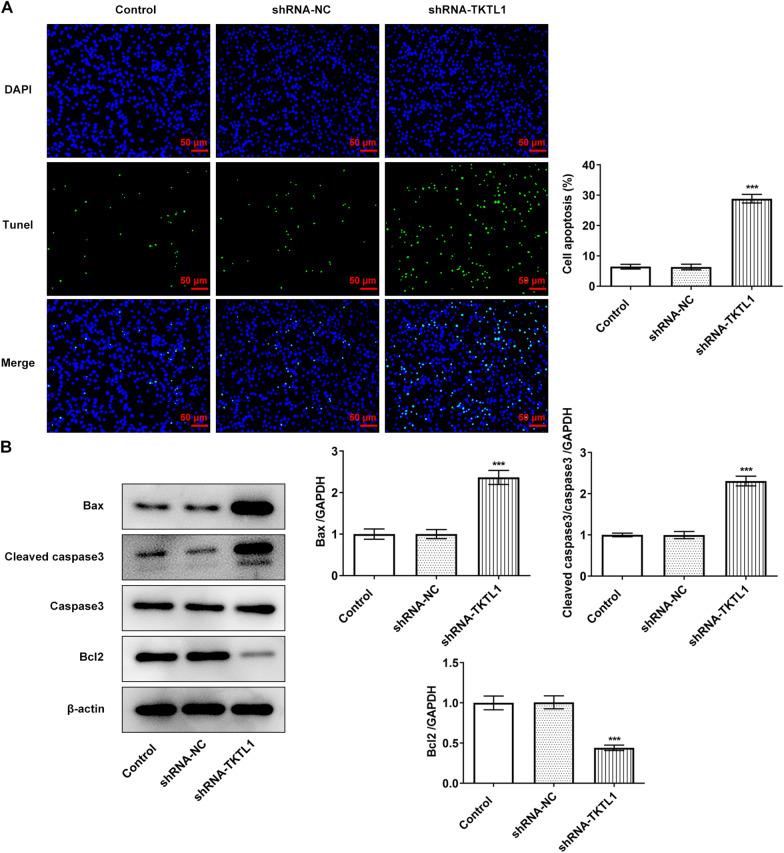 https://cdn.ncbi.nlm.nih.gov/pmc/blobs/0685/8684167/1c0f48f81ad9/12935_2021_2383_Fig3_HTML.jpg