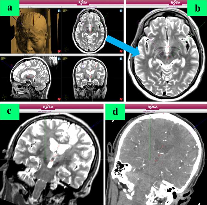 https://cdn.ncbi.nlm.nih.gov/pmc/blobs/068f/7536209/94393de85b26/41531_2020_130_Fig1_HTML.jpg