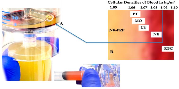 https://cdn.ncbi.nlm.nih.gov/pmc/blobs/069e/10377284/fd6181f5564c/biomedicines-11-01922-g002.jpg