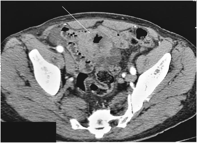 https://cdn.ncbi.nlm.nih.gov/pmc/blobs/069f/9403291/f166a38de5ac/gr1.jpg