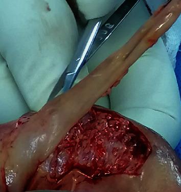 https://cdn.ncbi.nlm.nih.gov/pmc/blobs/06a1/7559505/2d79746894ec/CRIU2020-8822007.003.jpg