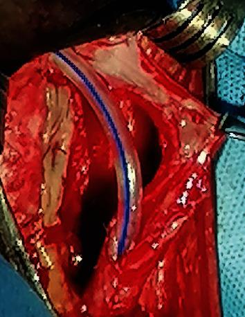 https://cdn.ncbi.nlm.nih.gov/pmc/blobs/06a1/7559505/adf12026faff/CRIU2020-8822007.006.jpg
