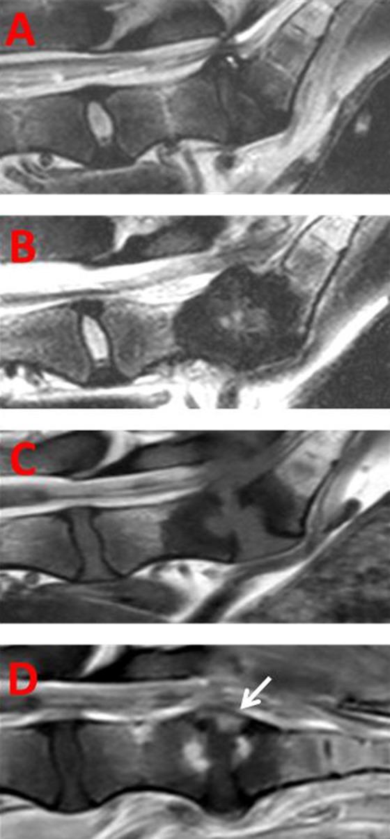 https://cdn.ncbi.nlm.nih.gov/pmc/blobs/06a5/6362527/13407a87cdab/10.1177_0963689718815459-fig4.jpg