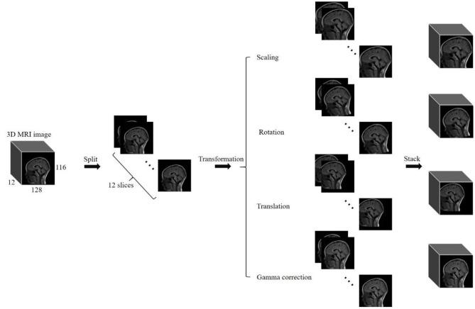 https://cdn.ncbi.nlm.nih.gov/pmc/blobs/06ad/7604456/da42190d2451/fneur-11-584682-g0001.jpg