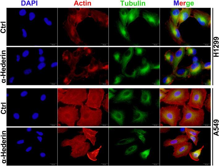 https://cdn.ncbi.nlm.nih.gov/pmc/blobs/06af/11164981/78f930f3aaac/41598_2024_63348_Fig4_HTML.jpg