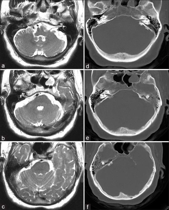 https://cdn.ncbi.nlm.nih.gov/pmc/blobs/06c2/6417288/808d0b7e61d1/AJNS-14-280-g001.jpg