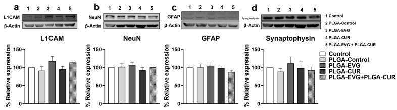 https://cdn.ncbi.nlm.nih.gov/pmc/blobs/06c4/12025016/b568b1245ed5/brainsci-15-00328-g006.jpg