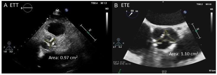 https://cdn.ncbi.nlm.nih.gov/pmc/blobs/06c6/11203729/fd5fad097c69/jcdd-11-00162-g005.jpg
