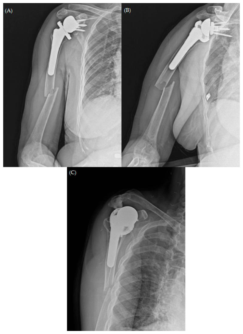 https://cdn.ncbi.nlm.nih.gov/pmc/blobs/06c7/10856593/d89fceb43f9e/jcm-13-00825-g001.jpg