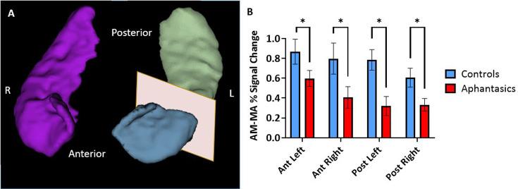 https://cdn.ncbi.nlm.nih.gov/pmc/blobs/06cd/11426968/e5dfa59d0ef3/elife-94916-fig2.jpg