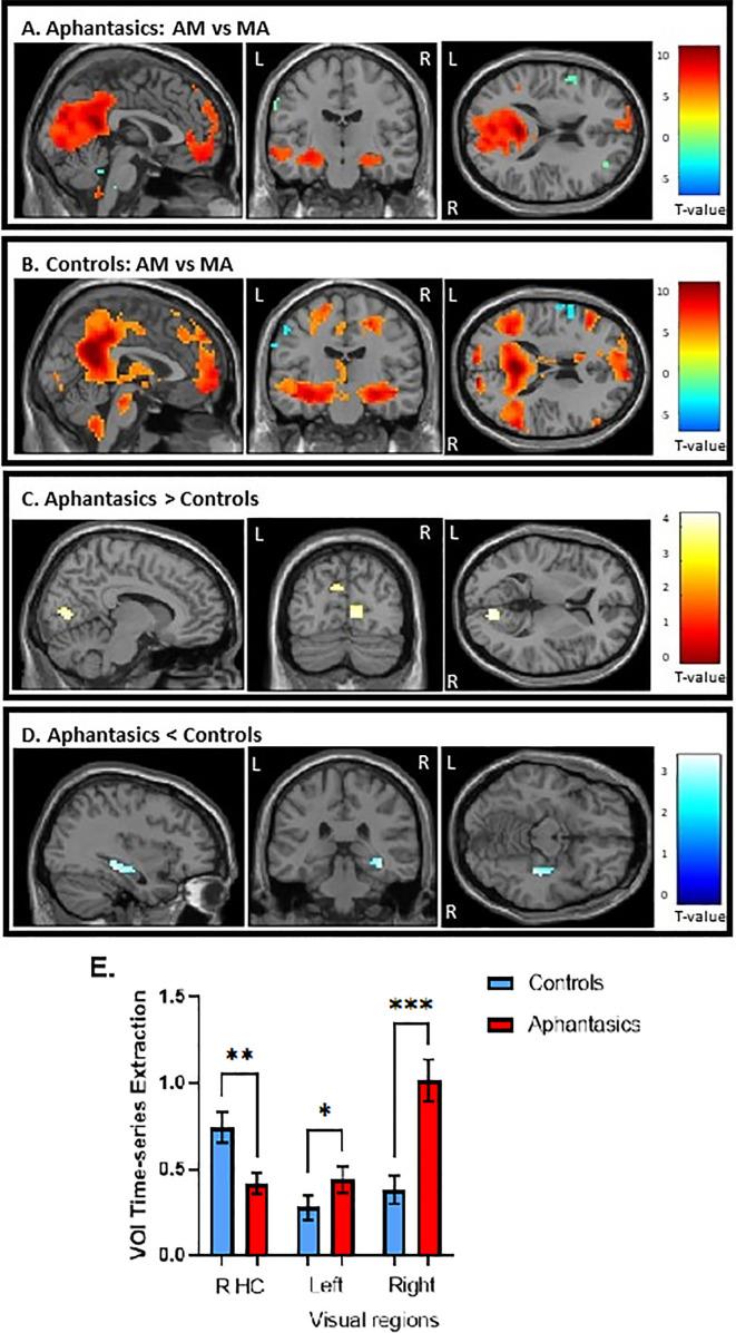 https://cdn.ncbi.nlm.nih.gov/pmc/blobs/06cd/11426968/ff4f5e6c2a91/elife-94916-fig3.jpg