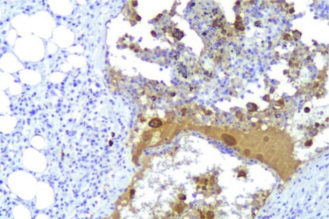 https://cdn.ncbi.nlm.nih.gov/pmc/blobs/06cd/12474557/22562947b03e/CCR3-13-e71041-g002.jpg