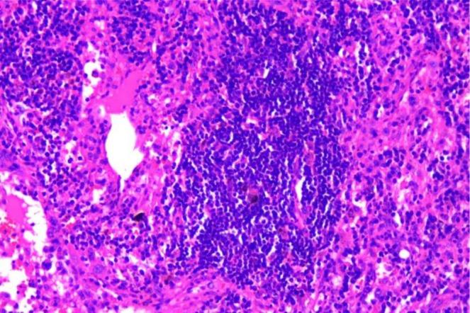 https://cdn.ncbi.nlm.nih.gov/pmc/blobs/06cd/12474557/a459e9fd4f41/CCR3-13-e71041-g001.jpg