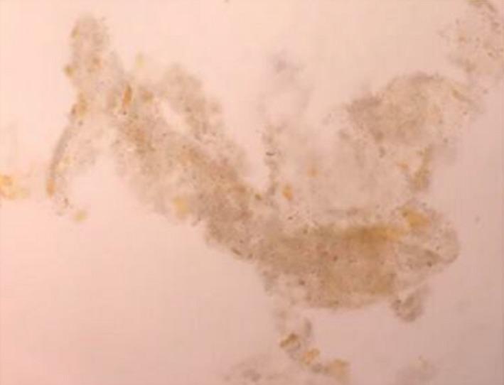 https://cdn.ncbi.nlm.nih.gov/pmc/blobs/06cf/5930206/4ca89f0ce3d6/CCR3-6-779-g001.jpg