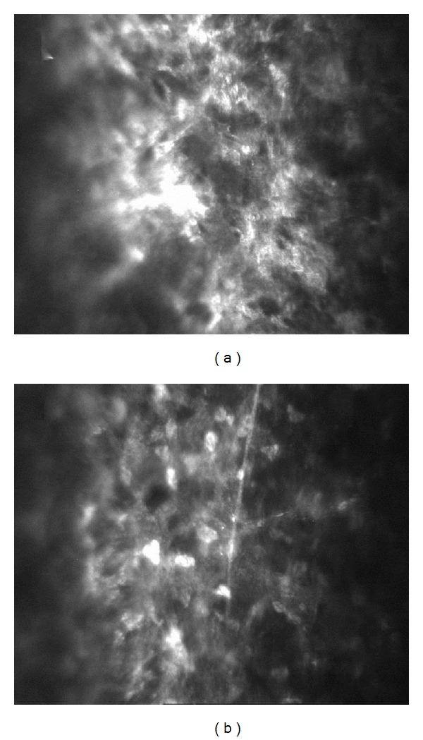 https://cdn.ncbi.nlm.nih.gov/pmc/blobs/06d0/4121279/b990ceed04c7/JOPH2014-784185.002.jpg