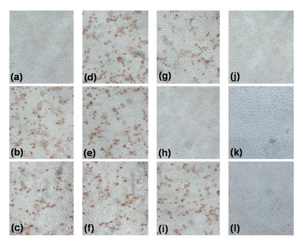 https://cdn.ncbi.nlm.nih.gov/pmc/blobs/06d3/3224128/593265caa0dc/1471-2180-11-188-5.jpg