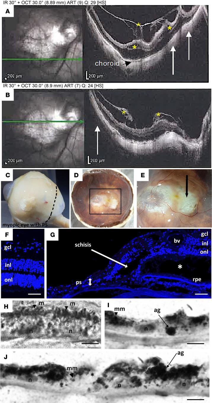 https://cdn.ncbi.nlm.nih.gov/pmc/blobs/06d7/12333944/5fe2eed57c1a/jciinsight-10-192929-g002.jpg