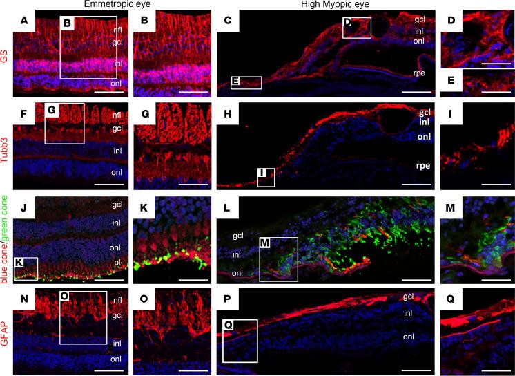 https://cdn.ncbi.nlm.nih.gov/pmc/blobs/06d7/12333944/849bb20d4b93/jciinsight-10-192929-g003.jpg