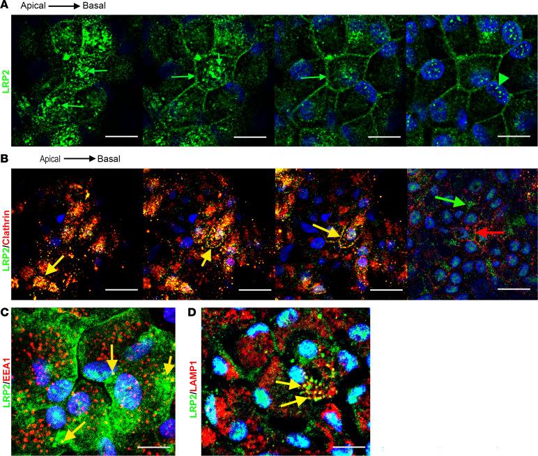 https://cdn.ncbi.nlm.nih.gov/pmc/blobs/06d7/12333944/ab76b50f5e2e/jciinsight-10-192929-g006.jpg