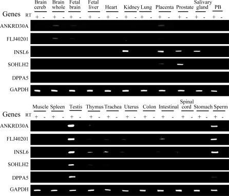 https://cdn.ncbi.nlm.nih.gov/pmc/blobs/06dd/2041996/47f86b022cc6/pgen.0030181.g003.jpg