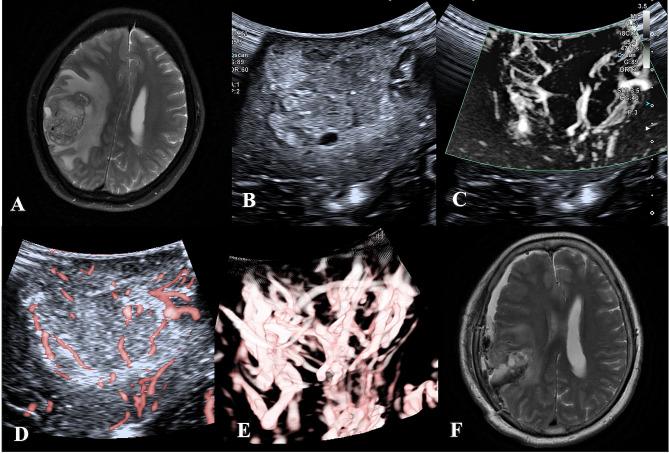https://cdn.ncbi.nlm.nih.gov/pmc/blobs/06e3/11165841/b71bada5427b/12880_2024_1321_Fig3_HTML.jpg