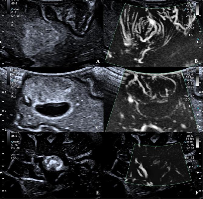 https://cdn.ncbi.nlm.nih.gov/pmc/blobs/06e3/11165841/ef4cc6c90be5/12880_2024_1321_Fig1_HTML.jpg
