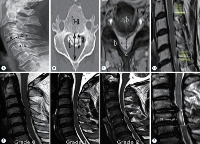 https://cdn.ncbi.nlm.nih.gov/pmc/blobs/06e6/7819792/6907575f672b/jkns-2020-0111f1.jpg