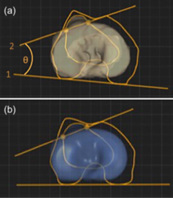 https://cdn.ncbi.nlm.nih.gov/pmc/blobs/06ef/12053445/51ea986f455e/JEO2-12-e70258-g002.jpg