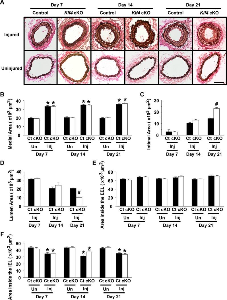 https://cdn.ncbi.nlm.nih.gov/pmc/blobs/06f0/3959705/20d2c8ffb558/jah3-3-e000622-g3.jpg