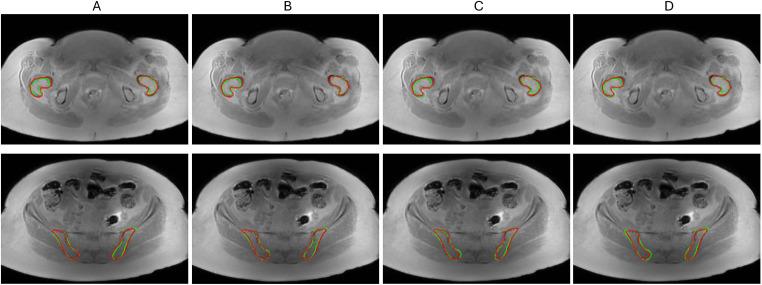 https://cdn.ncbi.nlm.nih.gov/pmc/blobs/0701/12140989/5823d32fc438/fonc-15-1498832-g003.jpg