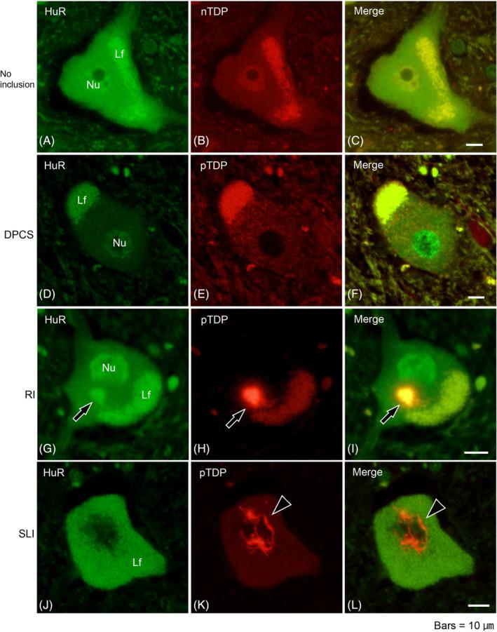 https://cdn.ncbi.nlm.nih.gov/pmc/blobs/0702/10901621/88561901b1ec/BPA-34-e13215-g004.jpg