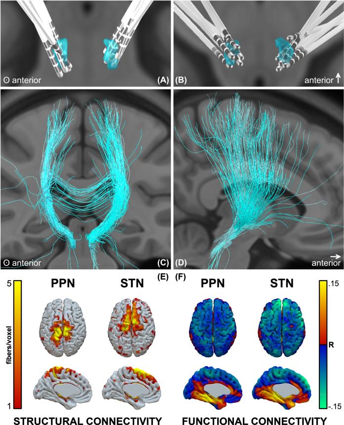 https://cdn.ncbi.nlm.nih.gov/pmc/blobs/0710/10357146/c05b7c672bc1/jpd-13-jpd225031-g003.jpg