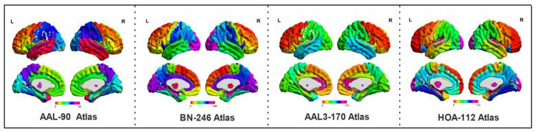https://cdn.ncbi.nlm.nih.gov/pmc/blobs/0711/9221217/8ddeb6b9e21e/brainsci-12-00751-g001.jpg