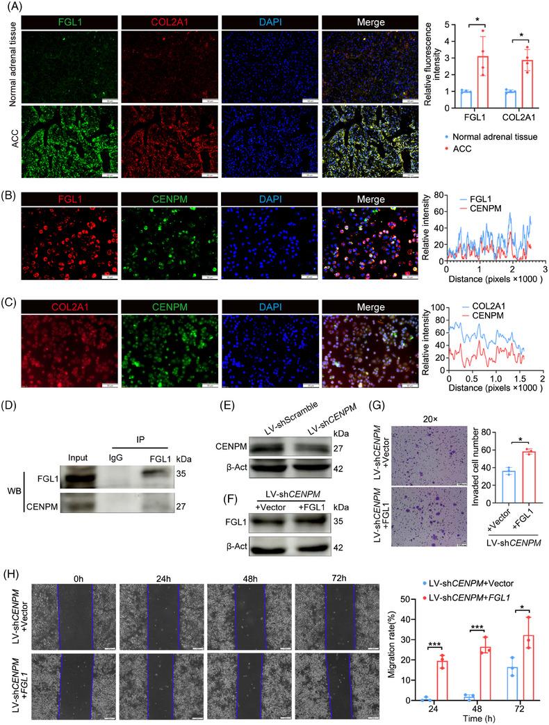 https://cdn.ncbi.nlm.nih.gov/pmc/blobs/0724/11707433/7b07130aa33b/CTM2-15-e70182-g001.jpg