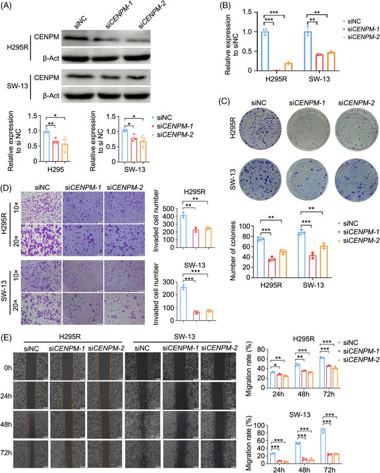 https://cdn.ncbi.nlm.nih.gov/pmc/blobs/0724/11707433/ae6645c5f005/CTM2-15-e70182-g007.jpg