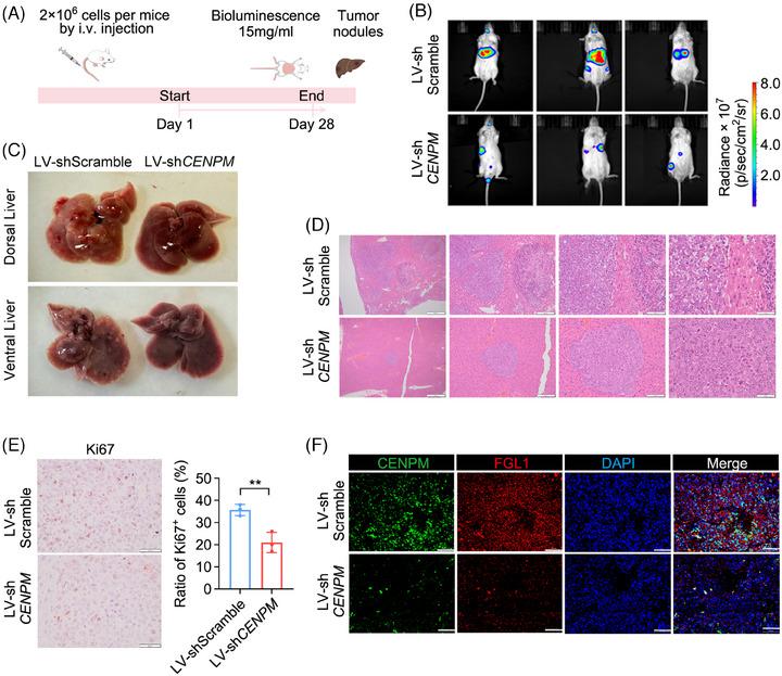 https://cdn.ncbi.nlm.nih.gov/pmc/blobs/0724/11707433/b2f092dc1aae/CTM2-15-e70182-g004.jpg