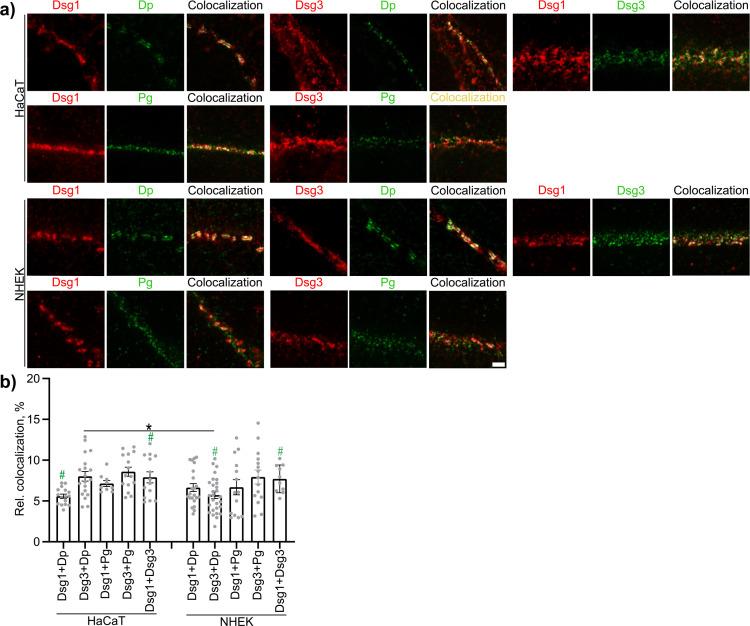 https://cdn.ncbi.nlm.nih.gov/pmc/blobs/072a/11774707/92f98dea9cc7/fimmu-15-1497241-g001.jpg