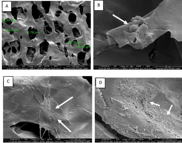 https://cdn.ncbi.nlm.nih.gov/pmc/blobs/072e/5227107/f9587ce75bfc/jsrm-12-83-g002.jpg