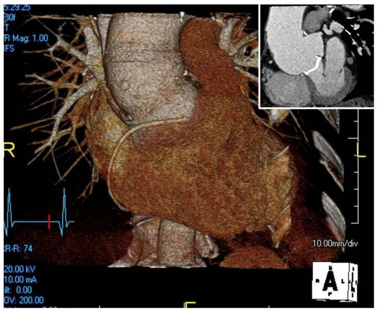 https://cdn.ncbi.nlm.nih.gov/pmc/blobs/073b/12386327/9617e8a971c1/jcm-14-05638-g001.jpg