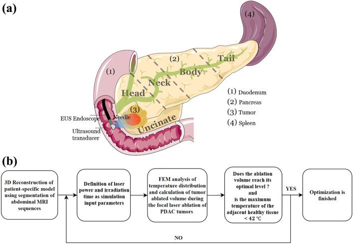 https://cdn.ncbi.nlm.nih.gov/pmc/blobs/0741/10329695/2943eace3f52/41598_2023_37859_Fig1_HTML.jpg