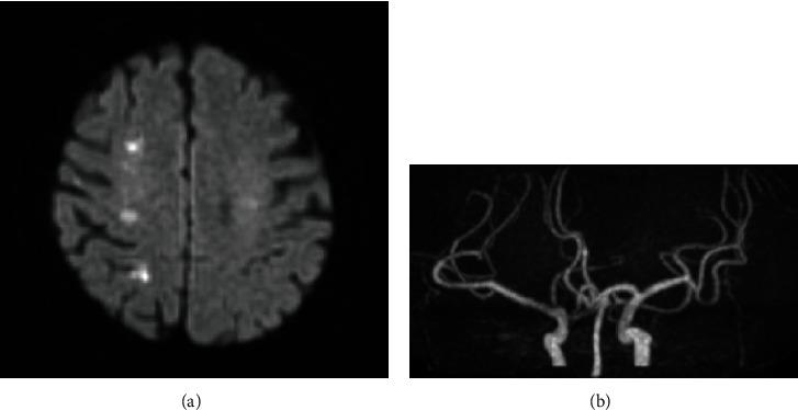 https://cdn.ncbi.nlm.nih.gov/pmc/blobs/074a/9007665/70e652b9c0b1/CRIOG2022-5537990.003.jpg