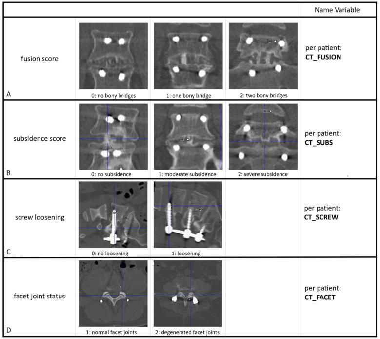 https://cdn.ncbi.nlm.nih.gov/pmc/blobs/074b/11240620/564518c864b7/diagnostics-14-01327-g001.jpg