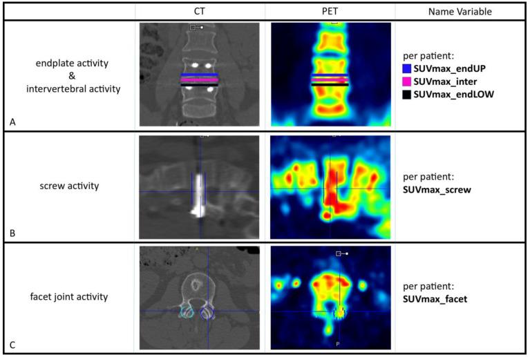 https://cdn.ncbi.nlm.nih.gov/pmc/blobs/074b/11240620/fd2efd7de0a4/diagnostics-14-01327-g002.jpg