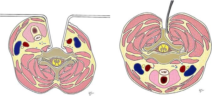 https://cdn.ncbi.nlm.nih.gov/pmc/blobs/0755/10293440/d0519d121788/10143_2023_2062_Fig1_HTML.jpg