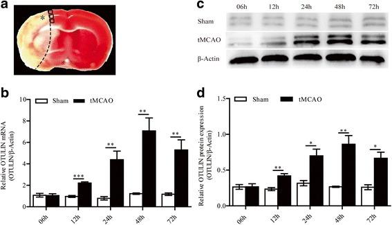 https://cdn.ncbi.nlm.nih.gov/pmc/blobs/0755/5856386/0ce5d66cd8de/12974_2018_1117_Fig1_HTML.jpg