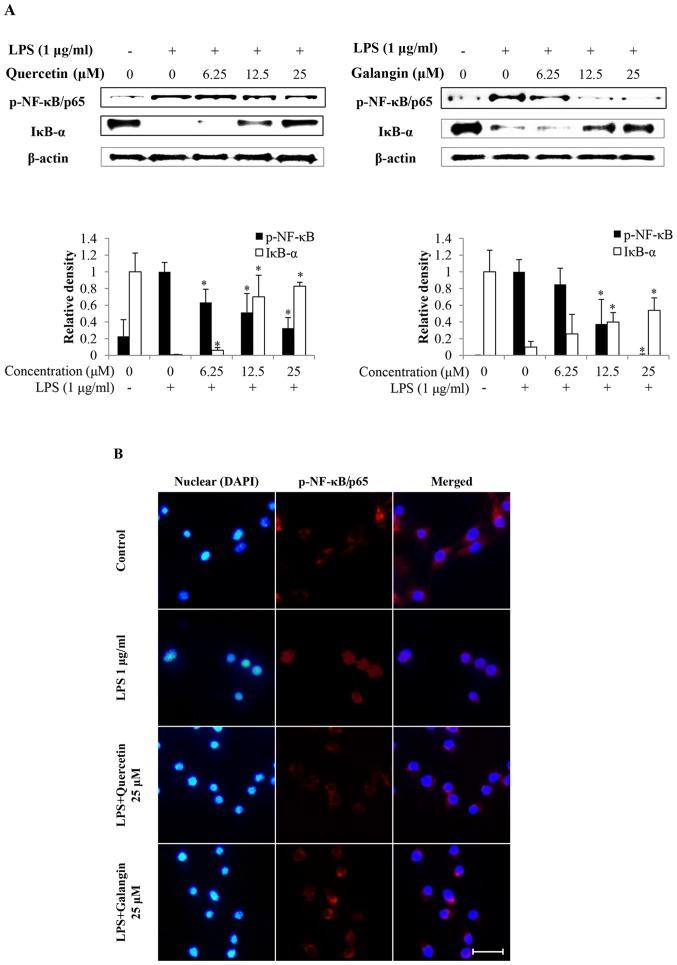 https://cdn.ncbi.nlm.nih.gov/pmc/blobs/0756/5752163/d2159c314f6b/IJMM-41-02-0888-g03.jpg