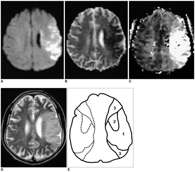 https://cdn.ncbi.nlm.nih.gov/pmc/blobs/0758/2686423/5da1ad87e562/kjr-6-75-g001.jpg